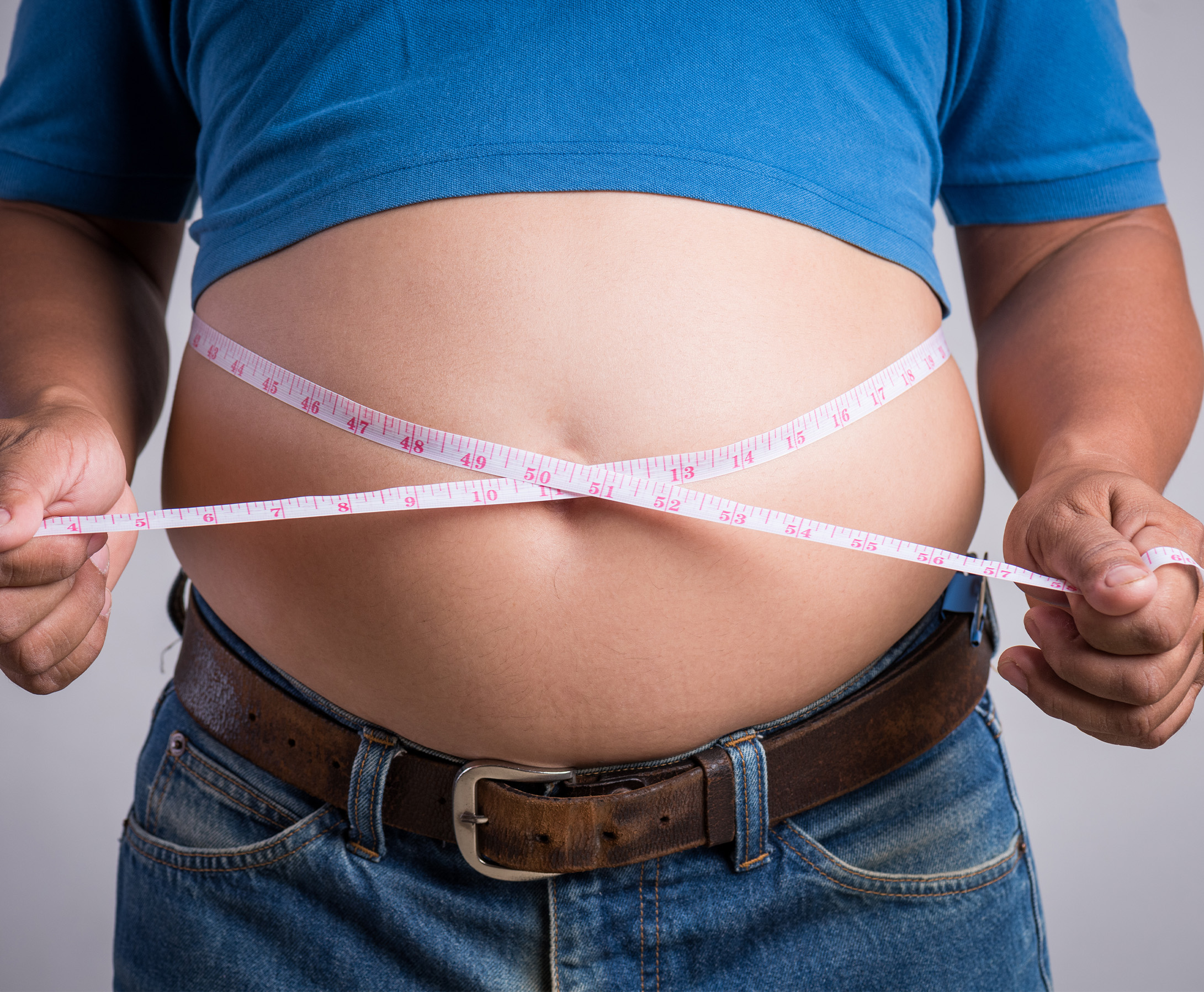 Obesity Treatment
