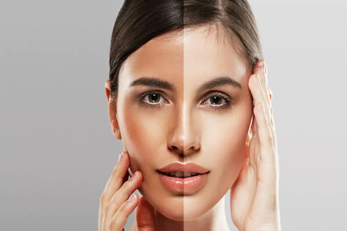 Is Skin Lightening Treatment the Secret to Glowing, Youthful Skin?