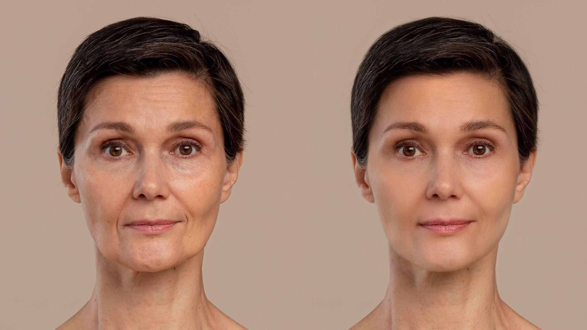 How Can You Reverse Facial Aging in Just 45 Minutes?