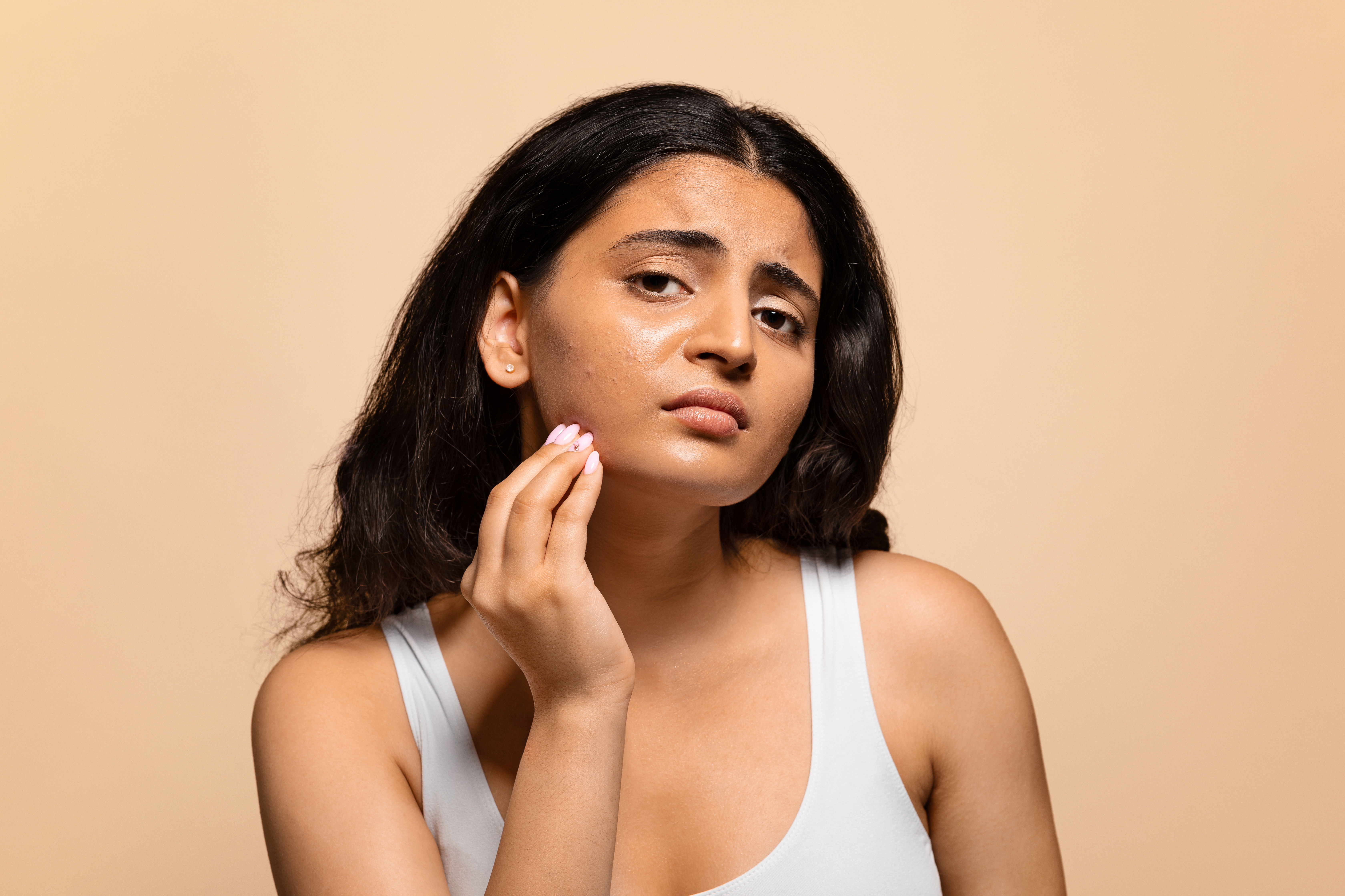 10 Skin Care Tips for Oily Skin That Really Work